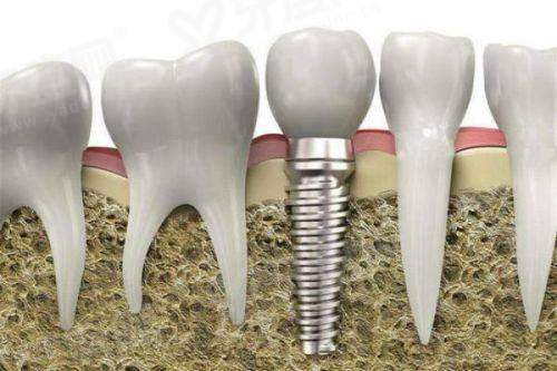 三、西安交大二附院口腔科价格表？（2024年参考价格，公开透明，性价比高）yanke.yadoo.cn