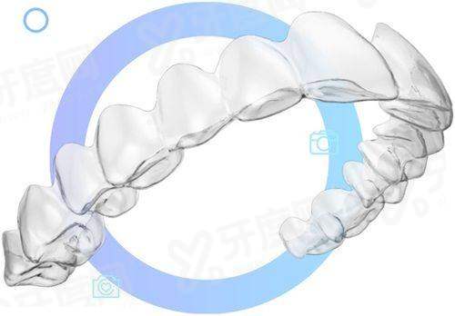 什么是3D数字化导板种植牙？一文看懂其核心优势、完整流程与临床种植效果