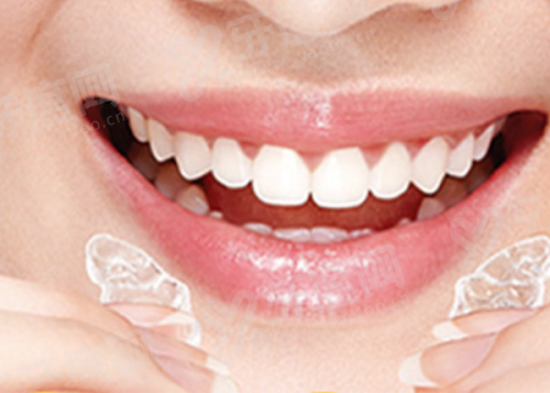 2026天津牙诚口腔医院价格表：种植牙2500+矫正5500+附地址路线