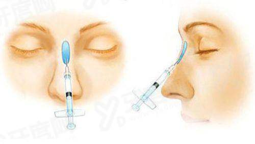 北京嘉禾孙景波修复双眼皮做得怎么样？擅长处理肉条/不对称/功能问题修复，患者满意度较高