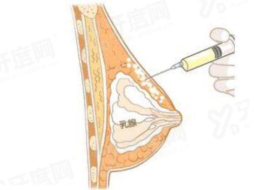 二、籍建华轮廓整形的价格参考yanke.yadoo.cn