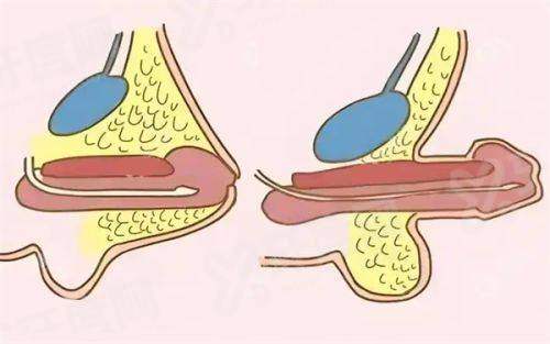 二、冯思阳医生做鼻子价位多少钱？yanke.yadoo.cn