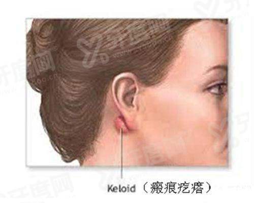 二、北京嘉禾孙景波修复双眼皮的真实患者评价yanke.yadoo.cn