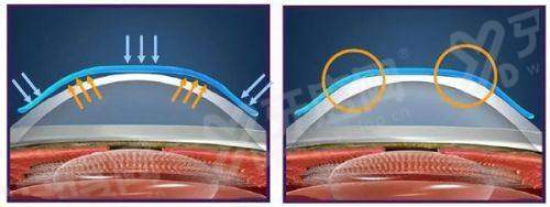 三、重庆千叶眼科医院地址电话：核心商圈好找，服务贴心yanke.yadoo.cn
