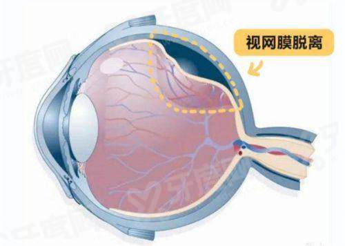 深圳全飞秒医院排名前十名：深圳希玛林顺潮/华厦/爱尔眼科医院上榜！