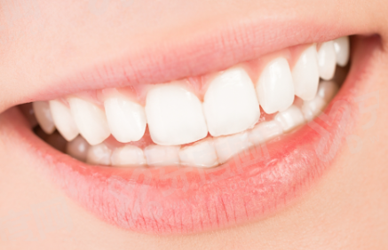 二、杭州雅莱口腔医院种牙技术好吗?原词嵌入？yanke.yadoo.cn