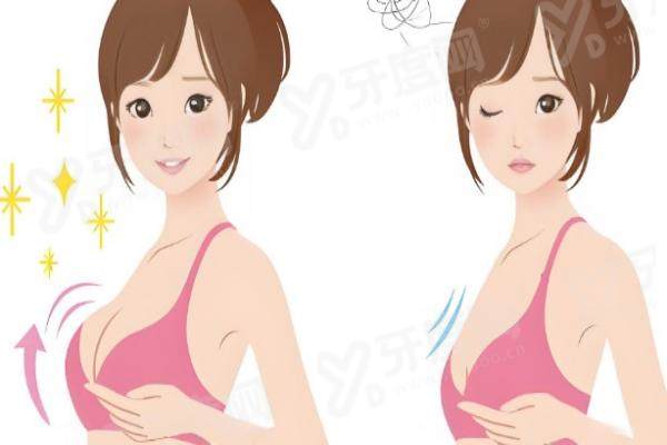 北京李比医生隆胸真的好吗？美莱李比定制方案自然持久，修复技术权威获口碑力荐