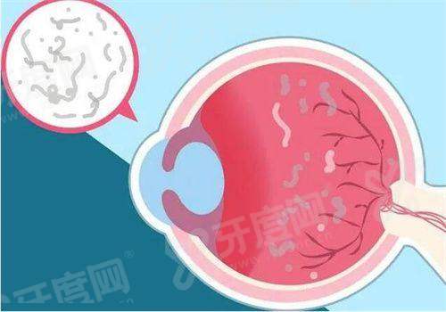 三、天水爱尔眼科医院价格表？（透明合理，公开可查）yanke.yadoo.cn