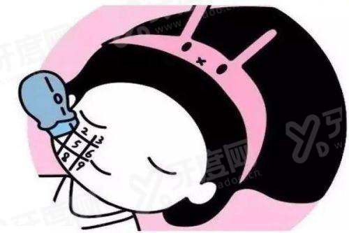 丁昆琨苹果肌复位怎么样？双U型复位技术让苹果肌饱满自然，维持5-10年