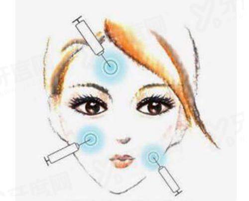 徐永丰医生鼻修复成效如何？（真实实例分享术后成效）yanke.yadoo.cn