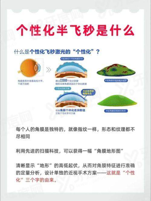 四、苏州光明眼科医院就诊指南yanke.yadoo.cn