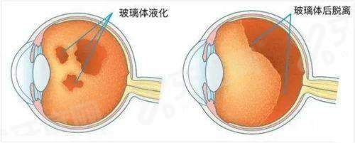 三、抚州光明眼科医院怎么预约？价格贵不贵？yanke.yadoo.cn