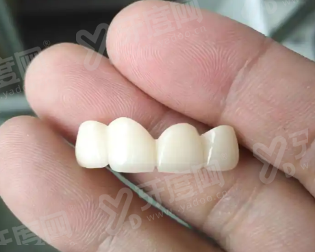 二、常州中诺口腔医院种植牙价格表?yanke.yadoo.cn