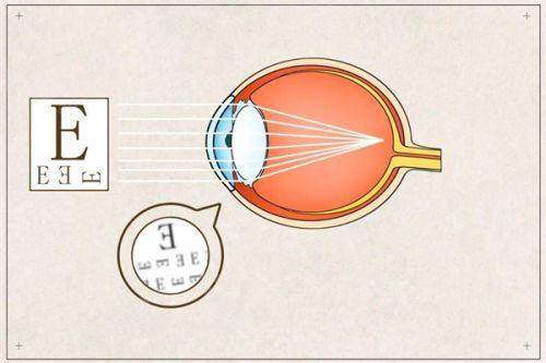 二、重庆西 南医院眼科价格表?(各项眼科项目收费公开透明)yanke.yadoo.cn