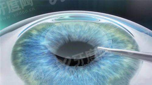 四、济南普瑞眼科医院坐诊地址及预约挂号方式yanke.yadoo.cn