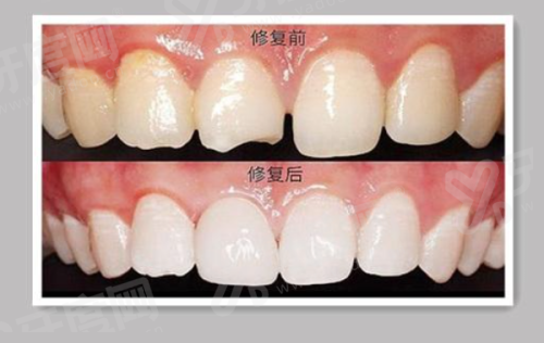 三、福州福能海峡口腔医院怎么样?正规连锁私人医院yanke.yadoo.cn