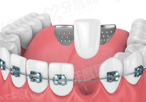 二、南京博韵口腔医院地址在哪里?江宁总院/玄武分院/秦淮分院yanke.yadoo.cn