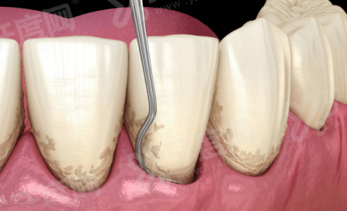 四、钦州立笑口腔医院坐诊地址及乘车路线yanke.yadoo.cn