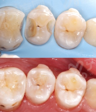 三、南京德立口腔医院怎么样？浦口区正规口腔医院，技术好口碑好yanke.yadoo.cn