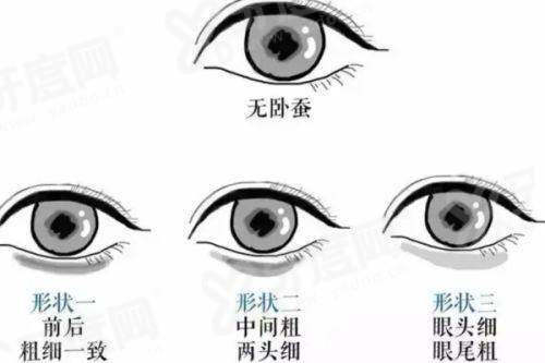 陈小平整形有没有失败实例？没有，技术精湛案例丰富，效果自然满意率高