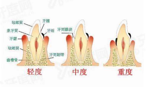 二、北京黎星医生取注射物怎样yanke.yadoo.cn
