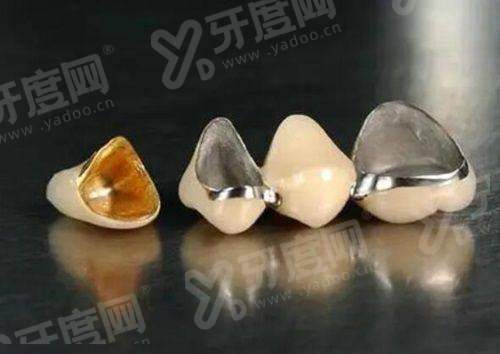 锦州种植牙好的医院有哪些？锦州瑞美/爱齿/维康口腔医院上榜前三！ 