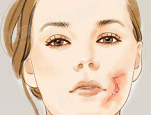 二、郑州孟宝玺双眼皮的真实患者评价yanke.yadoo.cn