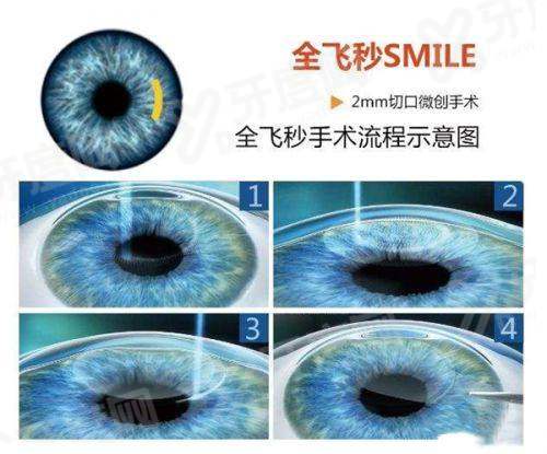 重庆西南医院眼科取消预约挂号怎么弄啊？多种方式取消+挂号，电话023-6876****