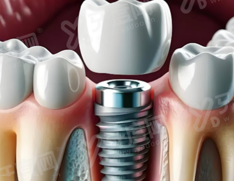 三、北京维尔齿美口腔医院地址电话？（地址好找，交通便利，电话随时询问）yanke.yadoo.cn