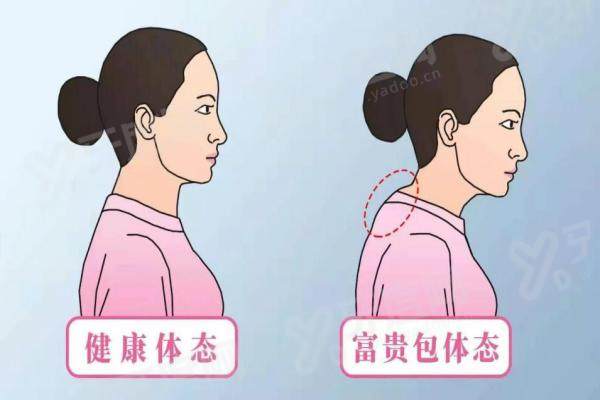 深圳富贵包手术哪个医院好？深圳美莱、鹏爱、艺星医疗美容医院上榜前三，技术优案例多等你来选！