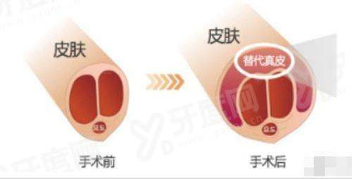 二、郑州邹程浩拉皮项目价格参考yanke.yadoo.cn