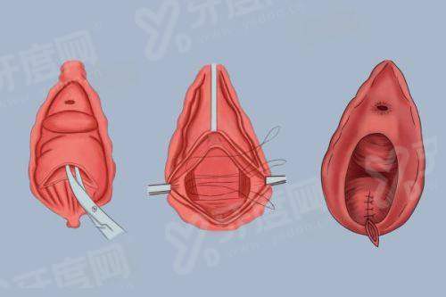 二、深圳安美聚光整形医院价格表yanke.yadoo.cn