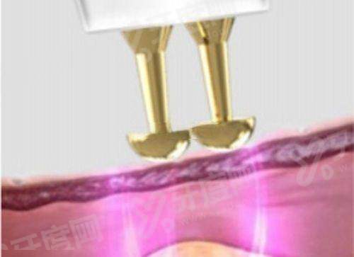 三、成都双眼皮修复常见问题解答yanke.yadoo.cn