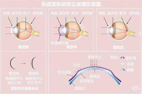 二、曲靖爱尔眼科医院怎么样？（连锁品牌有保护，技术服务双在线）yanke.yadoo.cn