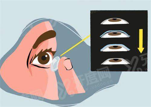 二、乌鲁木齐空军 医院眼科怎么样？（正规专精，技术实力强，服务优质）yanke.yadoo.cn