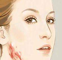 成都卢尚兵和高亮双眼皮修复谁更厉害？口碑都不错，结合自身需求选适合的