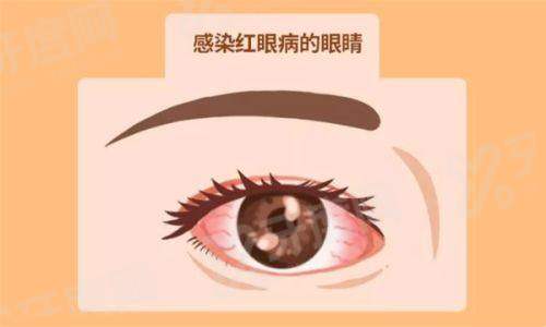 万州全准分子激光手术排名榜：万州爱尔/普瑞/新视界眼科医院上榜