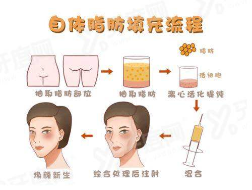 卢尚兵双眼皮修复是营销的吗？不是哦，技术靠谱还有真实案例可参考呢