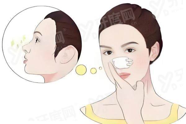 上海李章鼻修复怎么样？专业手法重塑鼻型，个性化方案让术后效果自然又持久