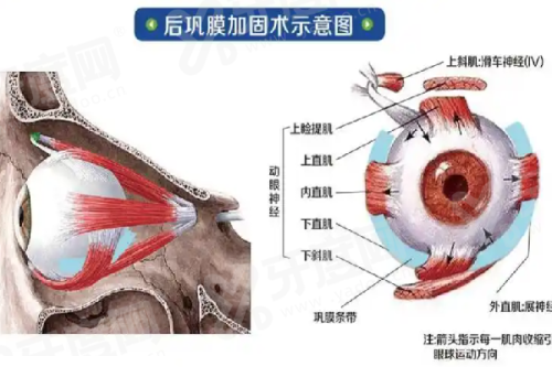三、深圳艺星牛克辉双眼皮价格表yanke.yadoo.cn