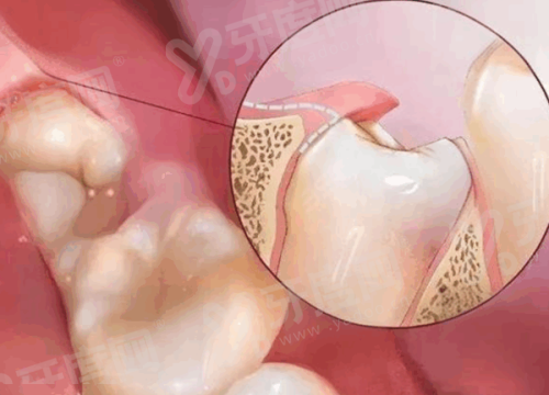 二、武汉大学口腔医院哪个院区好？yanke.yadoo.cn