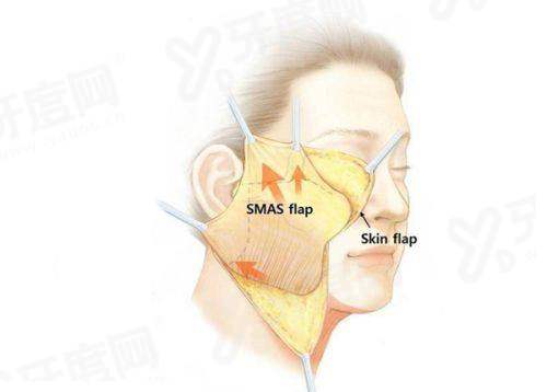 三、深圳联合丽格医疗美容医院热门项目及价格参考yanke.yadoo.cn