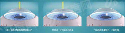 四、湘雅二医院眼科就诊攻略(地址/挂号/医疗保险指南)yanke.yadoo.cn