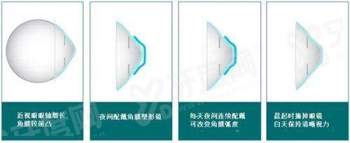 三、竹山爱尔眼科医院价格表?(项目价格透明,满足不同患者需求)yanke.yadoo.cn