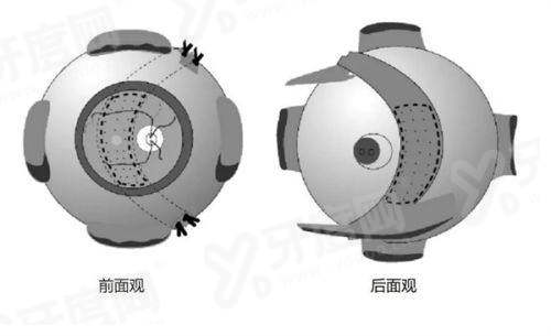 三、天津爱尔眼科医院地址在哪？（位于天津市南开区，交通便利）yanke.yadoo.cn