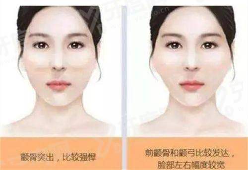 三、土麦森吸脂哪个医院有？深圳曹孟君医疗美容医院有哦yanke.yadoo.cn