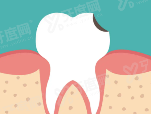 韩国纽百特和仕诺康的区别：仕诺康性价比高，附两者价格表