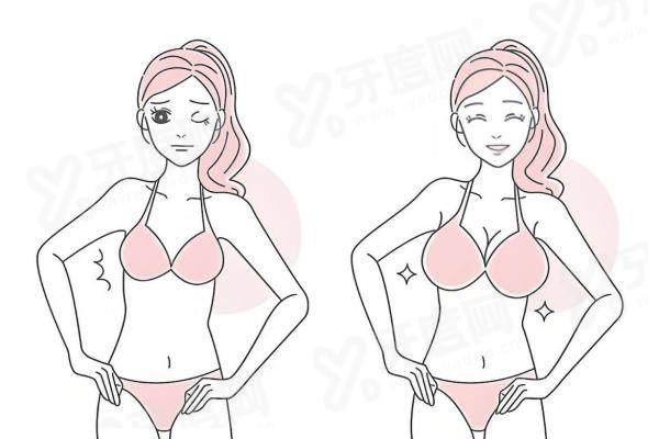 杭州隆胸哪家医院好？杭州艺星、美莱、维多利亚这三家医院隆胸技术超棒，值得考虑！