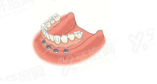 深圳市口腔医院地址在哪里？在罗湖区桂园北路70号，预约挂号方便