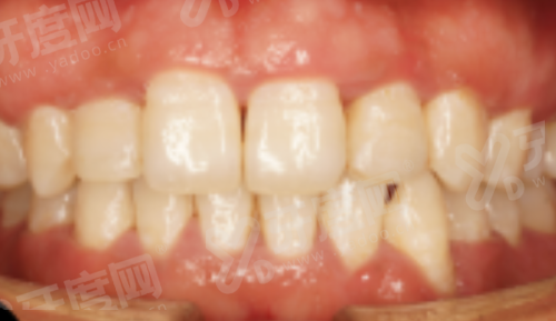 三、昆明柏德口腔收费高吗？看昆明柏德口腔收费价格表yanke.yadoo.cn